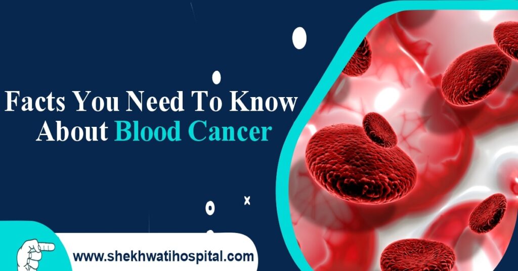 Facts You Need to Know About Leukemia (Blood Cancer)
