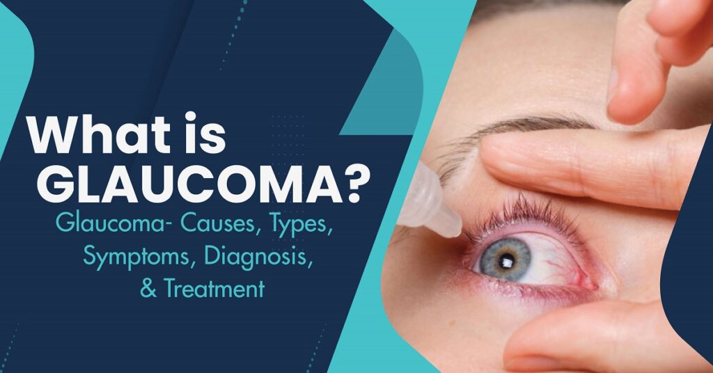 Glaucoma- Causes, Types, Symptoms, Diagnosis, and Treatment