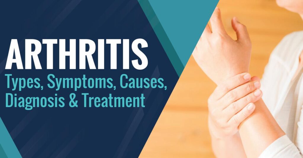 Arthritis: Types, Symptoms, Causes, Diagnosis & Treatment