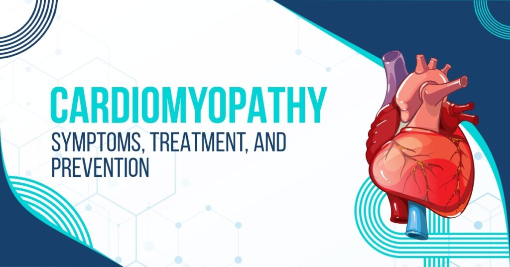 Cardiomyopathy Symptoms, Treatment, and Prevention