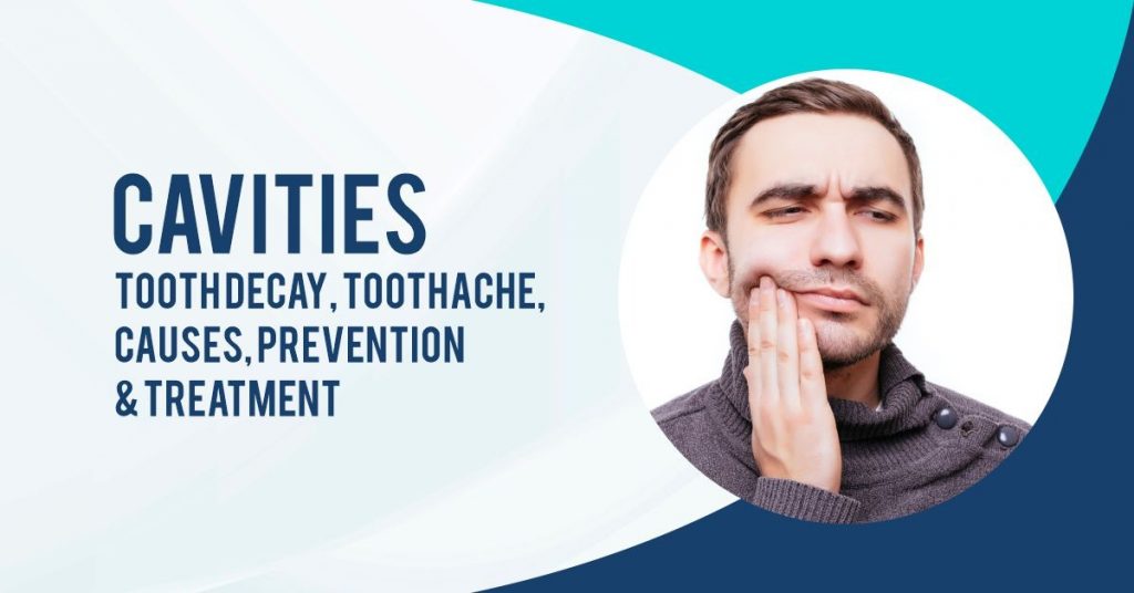 Cavities Tooth Decay, Toothache, Causes, Prevention & Treatment