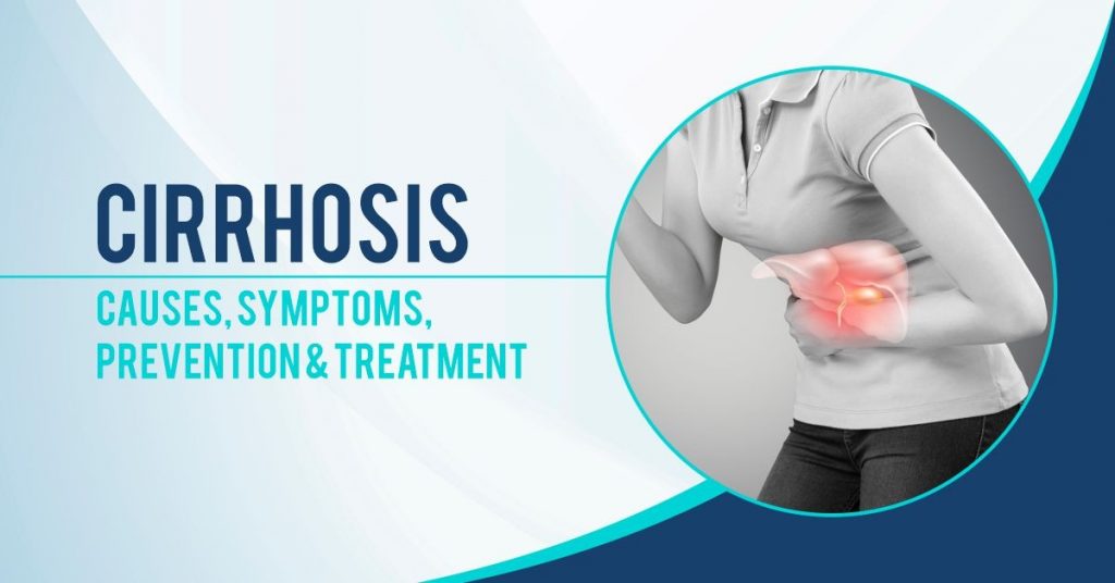 Cirrhosis- Causes, Symptoms, Prevention & Treatment