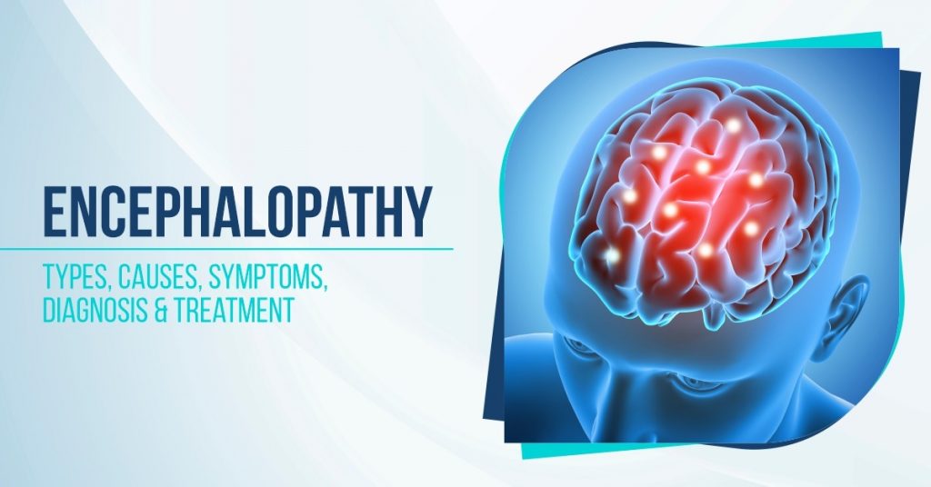 Encephalopathy: Types, Causes, Symptoms, Diagnosis & Treatment