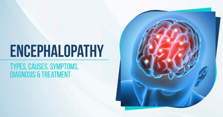 Encephalopathy: Types, Causes, Symptoms, Diagnosis & Treatment - GPSH ...