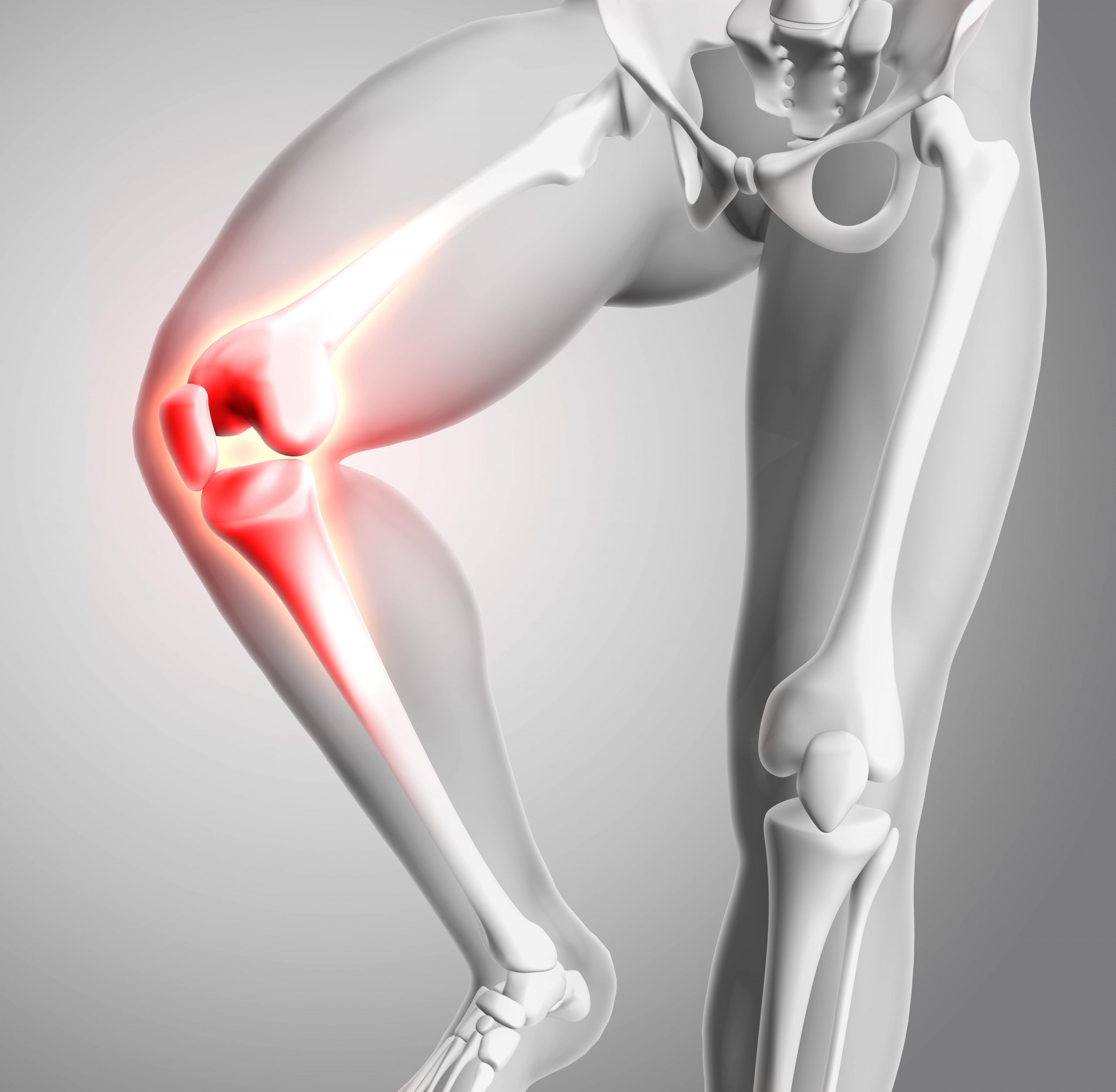 Best Joint Replacement Hospital Jaipur | shekhawati hospital