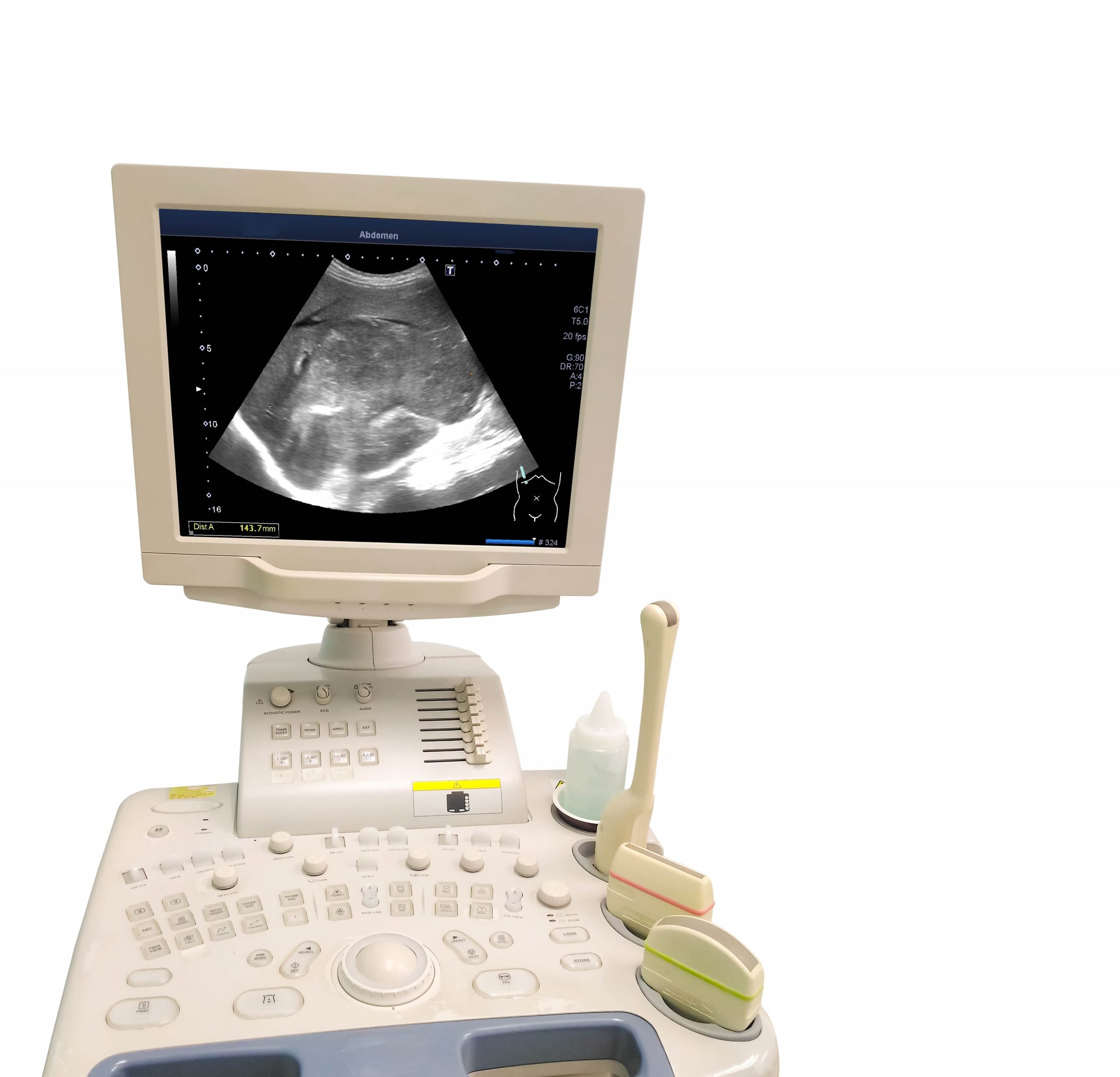 Obstetric USG Scan