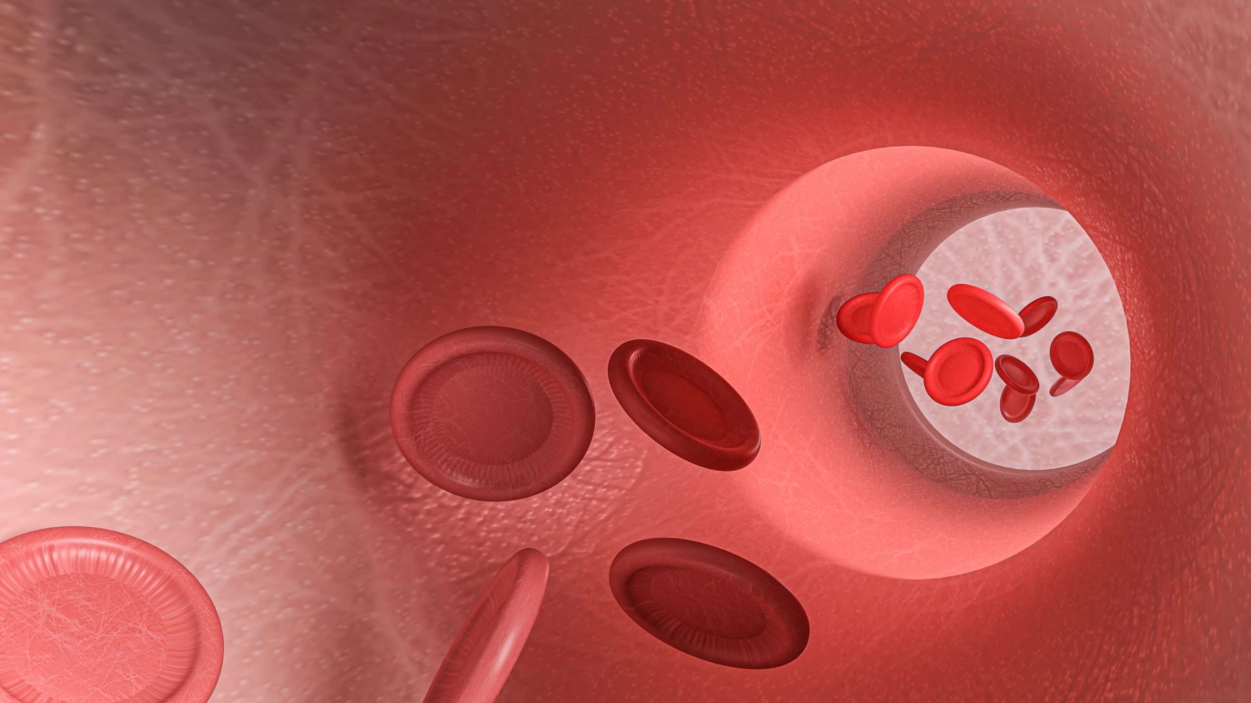 Argon Plasma Coagulation