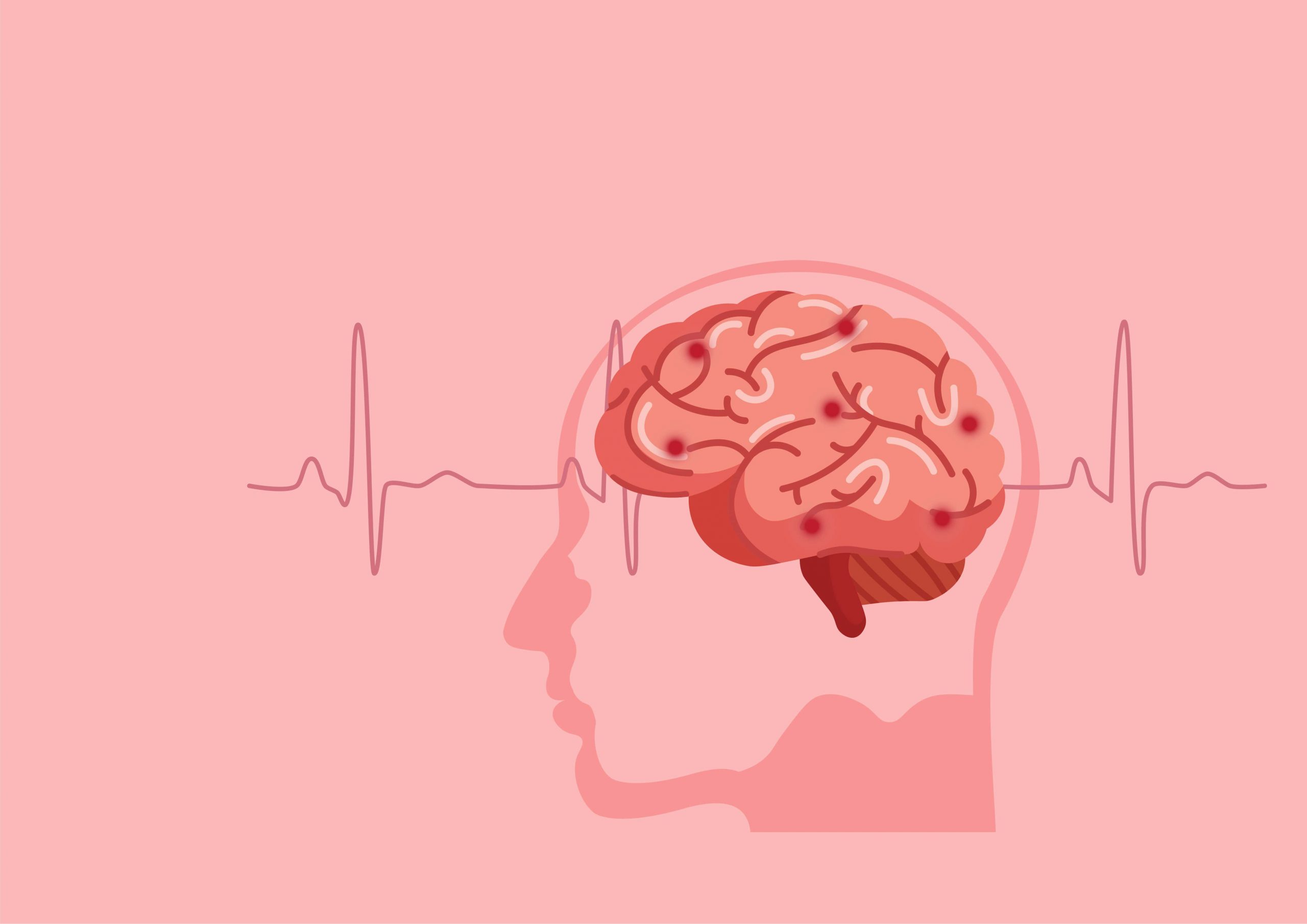 Multiple Sclerosis | best neurologist in jaipur