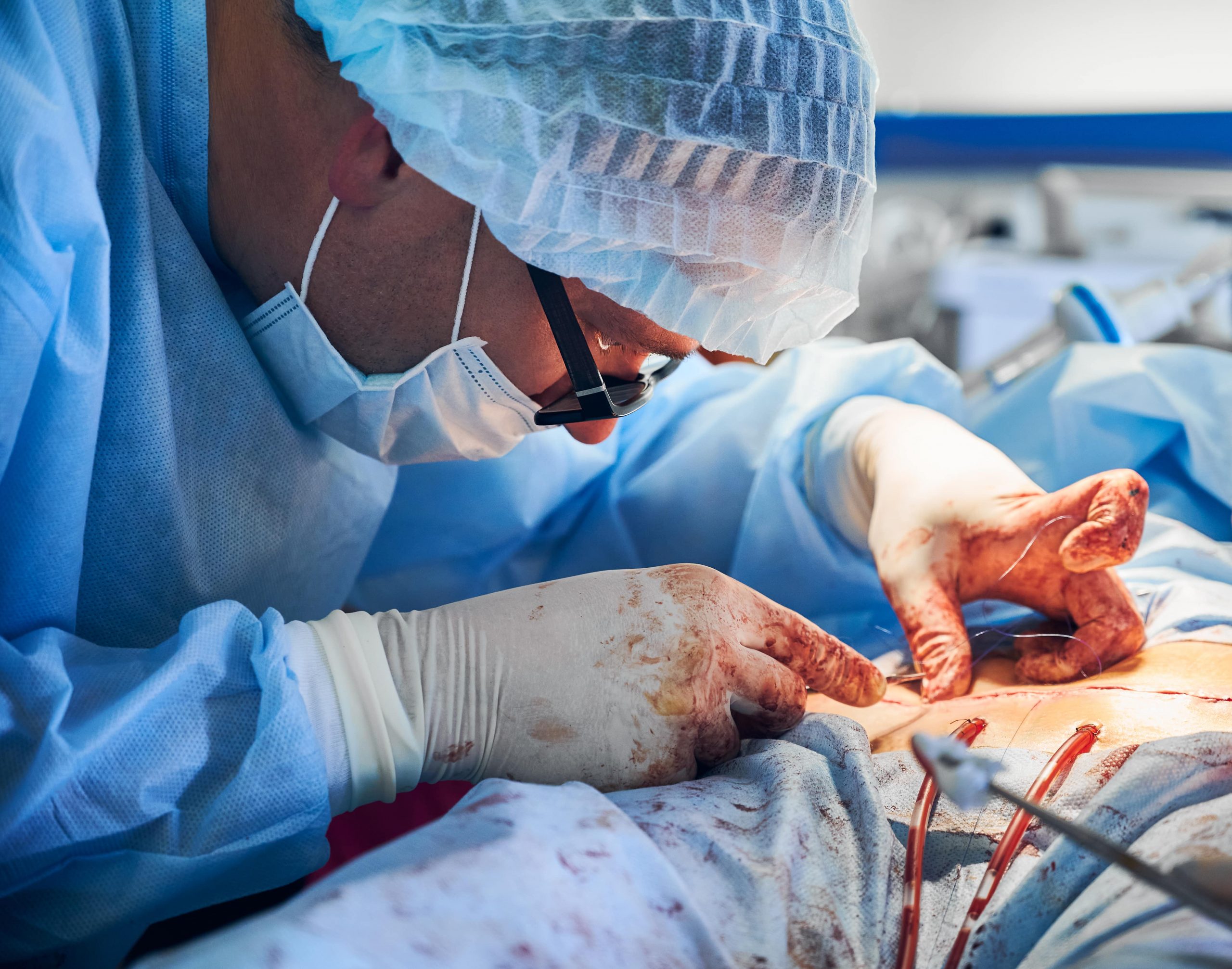 Partial and Radical Cystectomy | urology