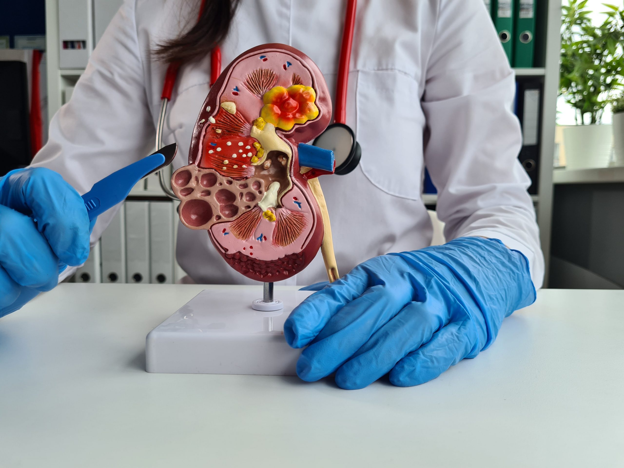 Ureteroscopic lithotripsy | urologist in jaipur