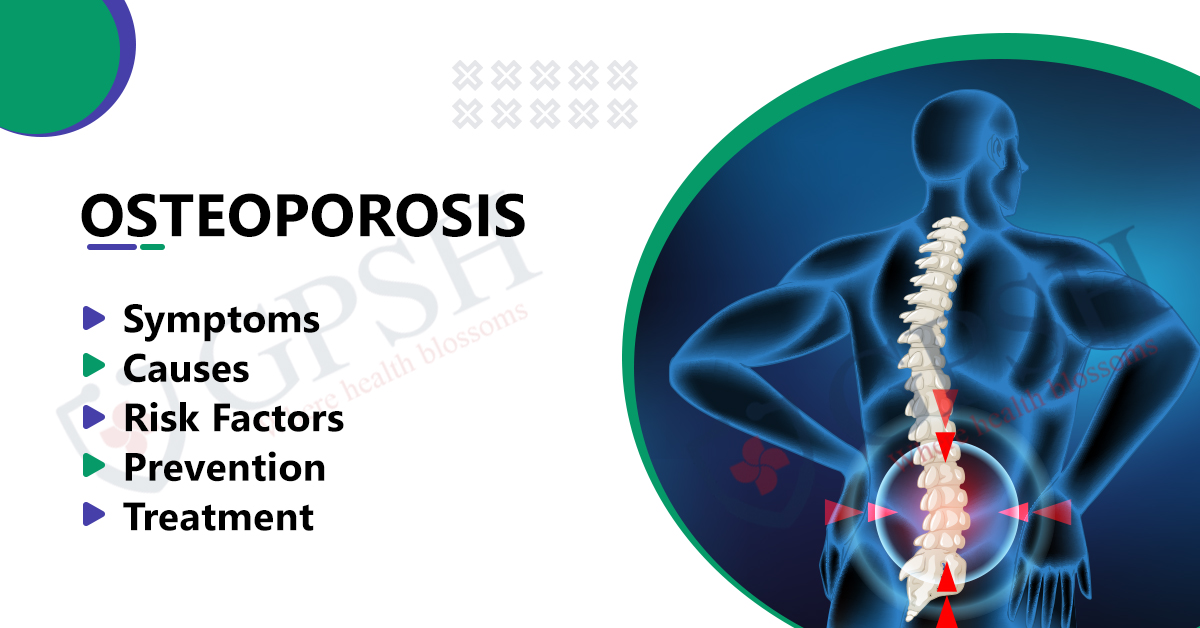 Osteoporosis: Symptoms, Causes, Risk Factors, Prevention and Treatment