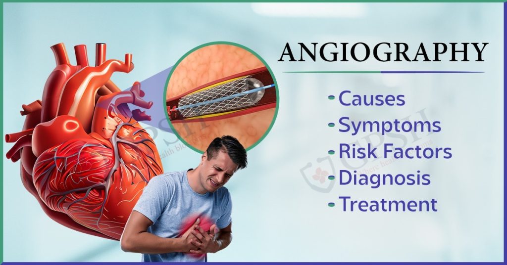 Angioplasty