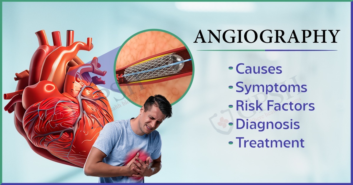 Angioplasty: Types, Benefits, Procedure, Risks, and Recovery