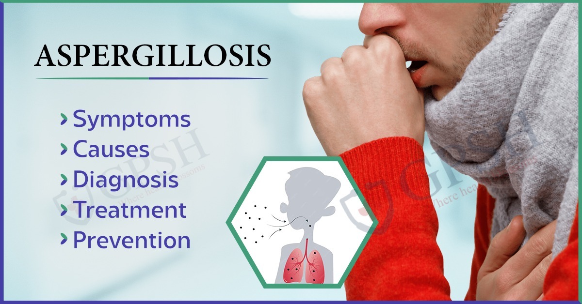 Aspergillosis: Symptoms, Causes, Diagnosis, Treatment, and Prevention