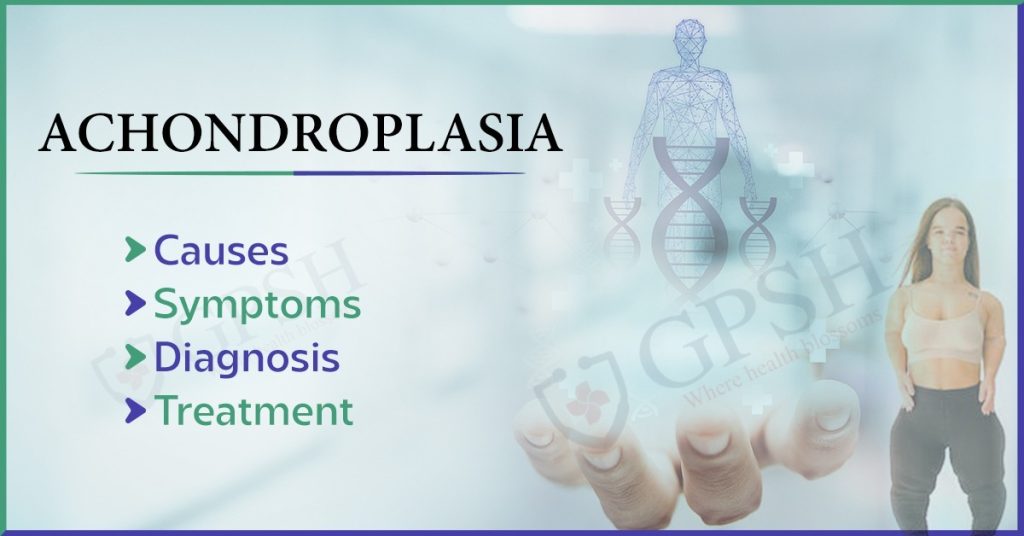 Achondroplasia