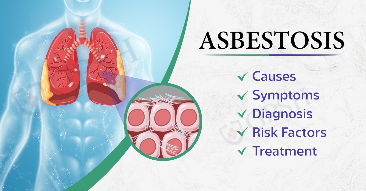 Asbestosis: Causes, Symptoms, Diagnosis, Risk Factors and Treatment