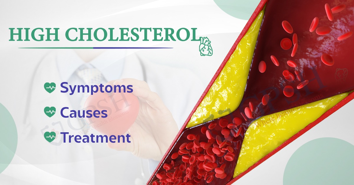 High Cholesterol: Symptoms, Causes and Treatment