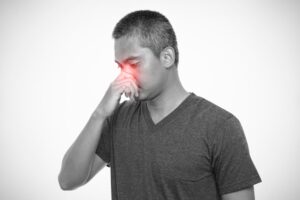 What is Nasal Polyps?