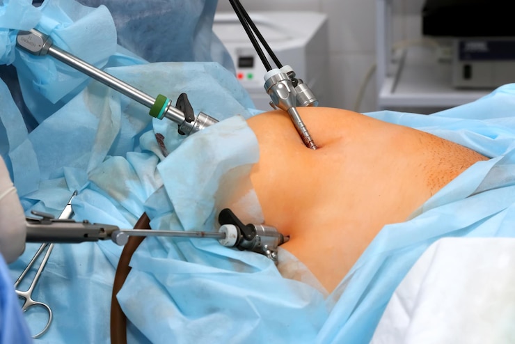 Upper GI Surgery