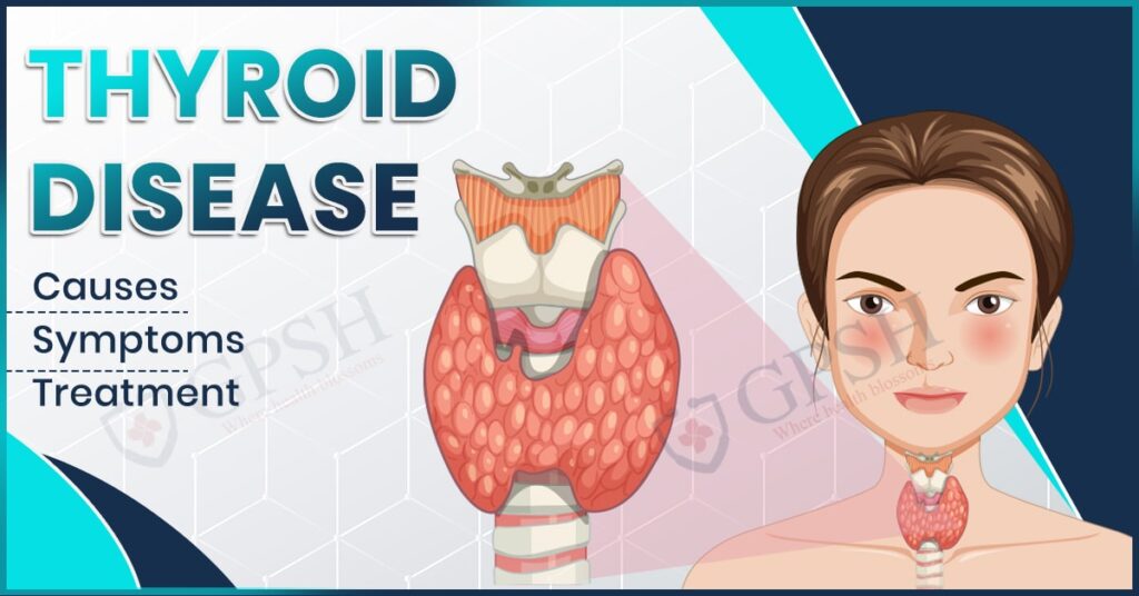 Thyroid Disease