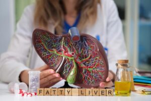 What Is Non-Alcoholic Fatty Liver Disease (NAFLD)?