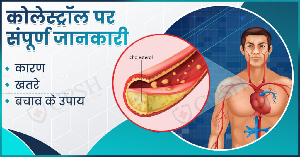 Cholesterol